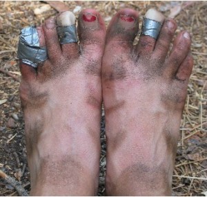 Manky Mucky Infected Feet...!!!